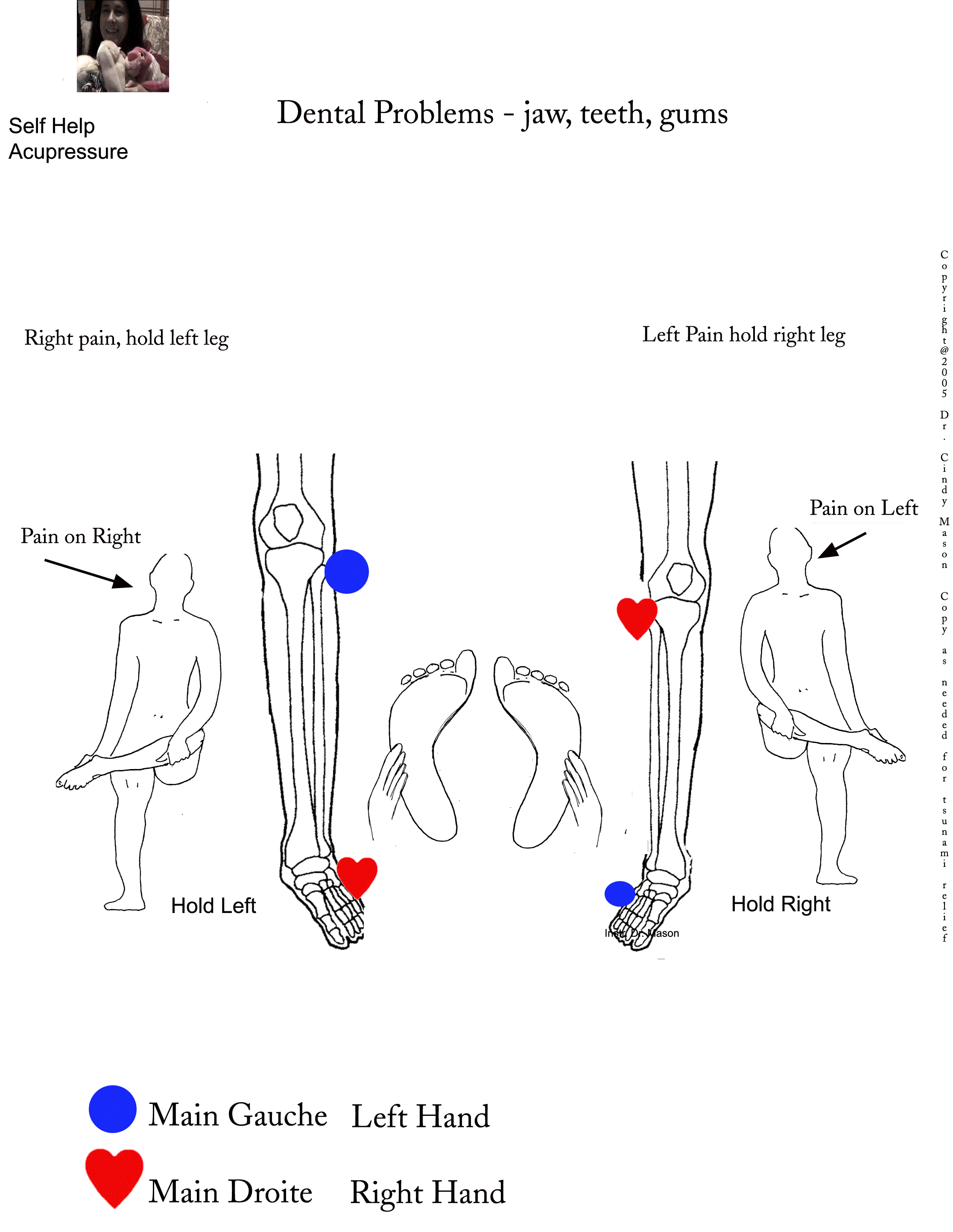 dentist - jaw, gums, teeth