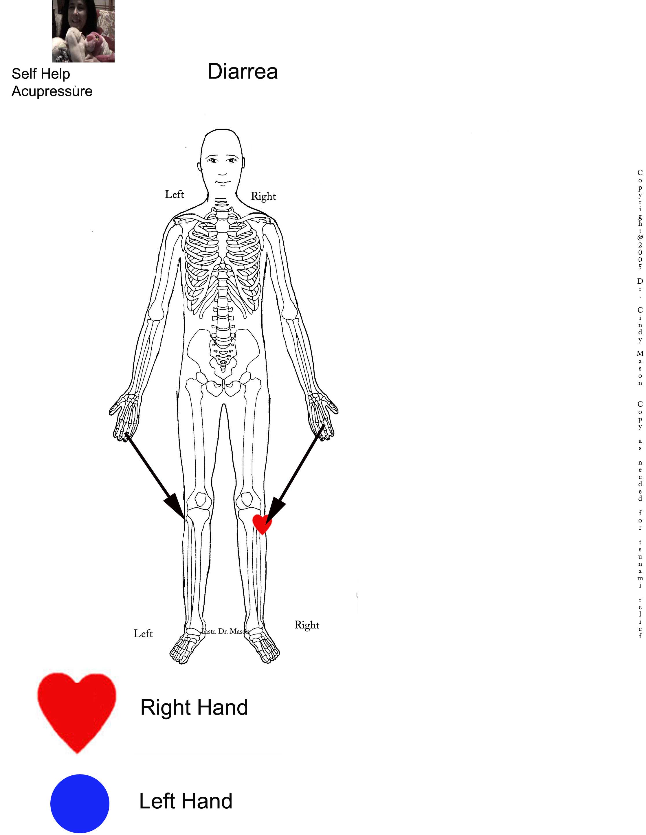 diarrea telemedicine self-help visual instruction 