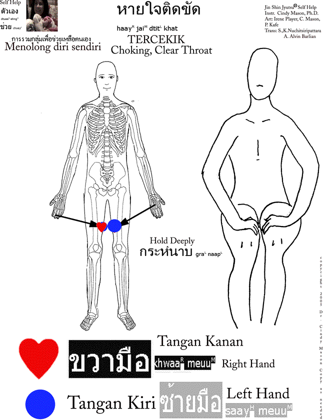   Tersedag,Tercekik Menolong Diri  Sendiri